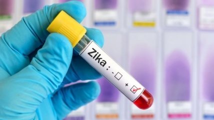 ВОЗ отменила чрезвычайное положение из-за вируса Зика
