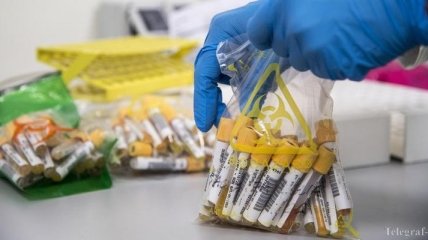 У Івано-Франківській області підтверджено 81 випадок коронавірусу