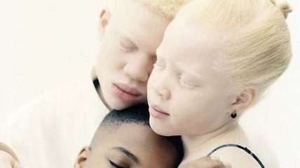 Дети-альбиносы и их чернокожий брат стали одними из самых необычных моделей Европы