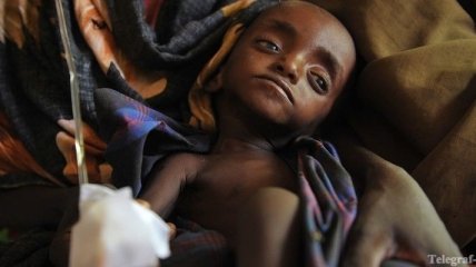 Голодающие дети принесут мировой экономике $125 млрд ущерба