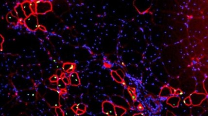 Стволовые клетки человека превратили в предшественников мышечной ткани