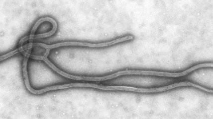 Ученые рассказали, когда и как возник вирус Эбола