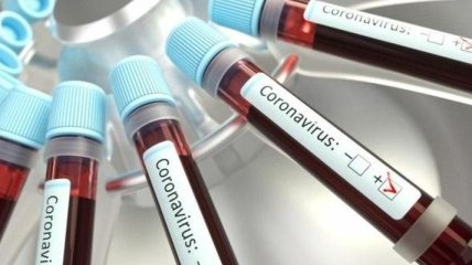 В Україні вже - 20 580 випадків коронавірусу
