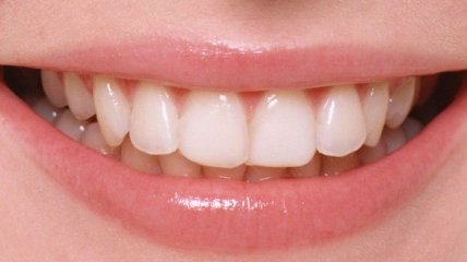 Самые важные продукты для здоровья зубов