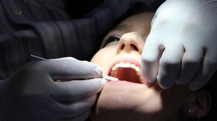 Стоматологи рассказали, как сохранить свои зубы