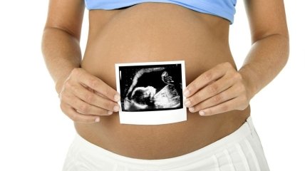 УЗИ во время беременности: делать или категорически отказаться?