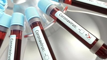 На Львовщине уже третий пациент выздоровел от коронавируса