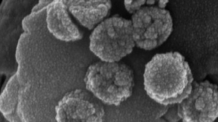 Ученые надеются на нано-очистители следующего поколения