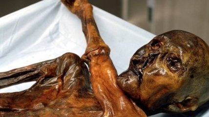 Ученые обнаружили вредоносную бактерию в мумии Эцы