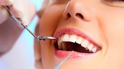 Дантисты рассказали, чем опасны зубные пломбы