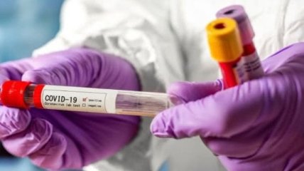 У ЗСУ за добу зафіксували два нових випадки коронавірусу