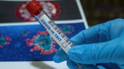 В Крыму резко возросло число пациентов с подозрением на коронавирус