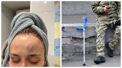 По словам девушки, работник ТЦК напал на нее