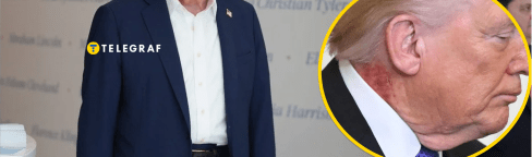 На шее Дональда Трампа заметили красное пятно
