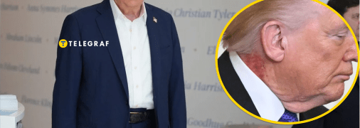 На шее Дональда Трампа заметили красное пятно