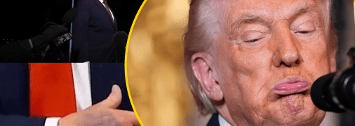 Дональд Трамп объяснил появление синяков на своих руках. Фото wsj