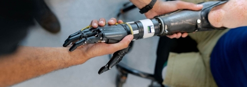 За протезом не обязательно ехать за границу