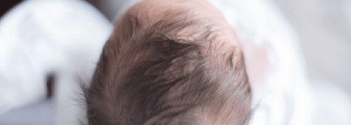 Почему у ребенка выпадают волосы