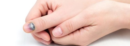 Травмы ногтей заживают долго