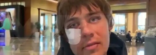 Проснулся - и получил в глаз: появилось видео с побитым российским футболистом