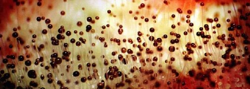 В Индии объявили эпидемию "черной плесени"