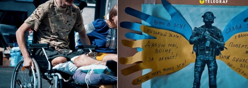 Більшість військових не хочуть ампутації, тому шукають шляхи відновити кінцівки