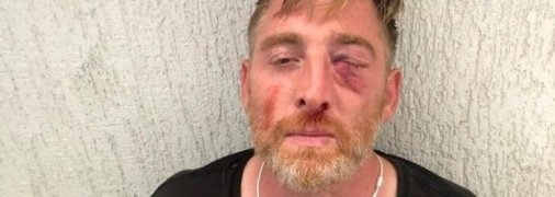 В Грузии скончался журналист, избитый во время ЛГБТ-марша (фото)