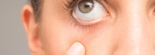 Болезни глаза летом возникают довольно часто