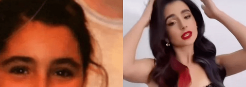 Анна Тринчер раньше была полненькой