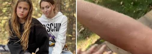 Доньки Полякової Аліса та Марія, а також нога Аліси