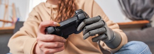 "Я покатався на електросамокаті і живий!" Як український стартап змінює світовий ринок протезування, ч.2