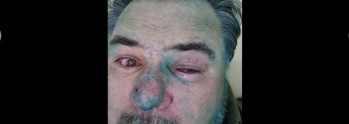 "Ходячая реклама "зеленой власти": в Ивано-Франковске напали на скандального блогера и активиста (видео)