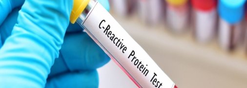 С-реактивний білок показує гостру фазу захворювання.