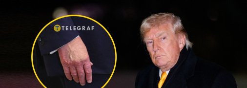 Дональд Трамп снова прячем синяки на руках
