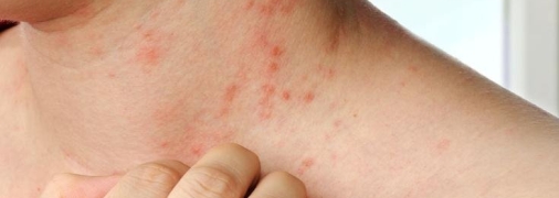 Кропивниця