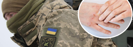 Непридатний до служби