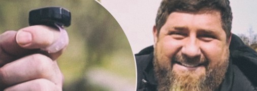 При всех заявлениях о "крепком здоровье" кадыров продолжает пухнуть почти на глазах