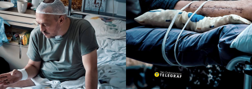 Щодня українці отримують поранення