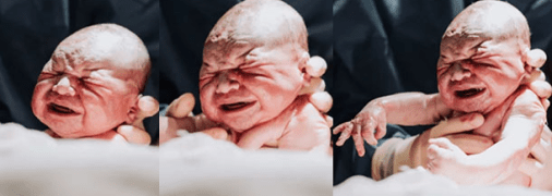 Женщина сфотографировала момент рождения своего сына