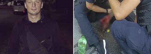 Руку собирали по крупинкам: показали фото травм подстреленного в Киеве полицейского (18+)