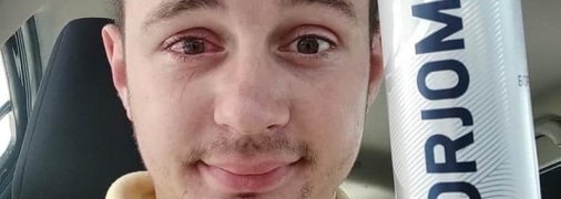 Пробка из-под минералки выстрелила парню в глаз: жертва ЧП записал эксперимент на видео