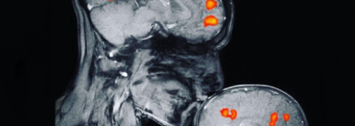 Вся правда о МРТ-снимке матери и ребенка, который гуляет по сети