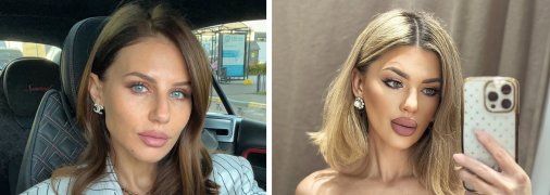 Анна Алхим и Елена Филонова нарвались на критику после примирения