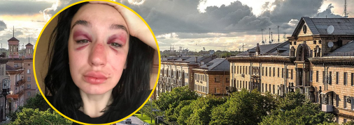 Избиение девушки в Запорожье: кадры с камер наблюдения указали на интересный момент (видео)