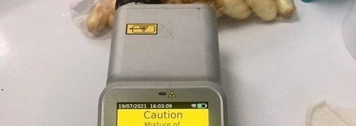 Бразильцы пытались ввести кокаин в Украину: один проглотил целый килограмм, второй оказался находчивее (фото)