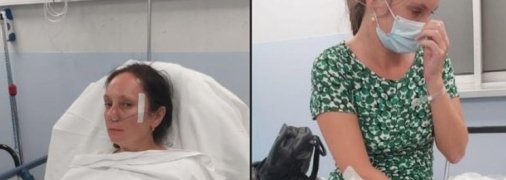 Женщины получили ушибы и ссадины