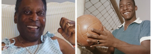 Чому помер Пеле: названо причину смерті легенди футболу