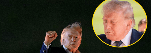 Дональд Трамп почав стрімко втрачати волосся