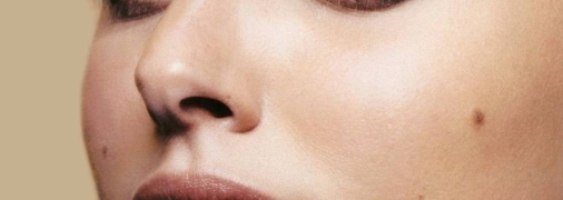 Родимка на обличчі Наталі Портман