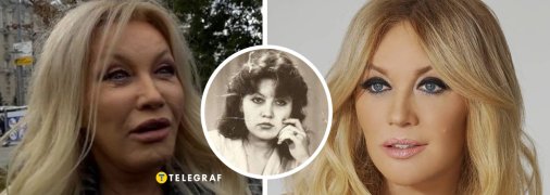 Таїсія Повалій зробила кілька пластичних операцій